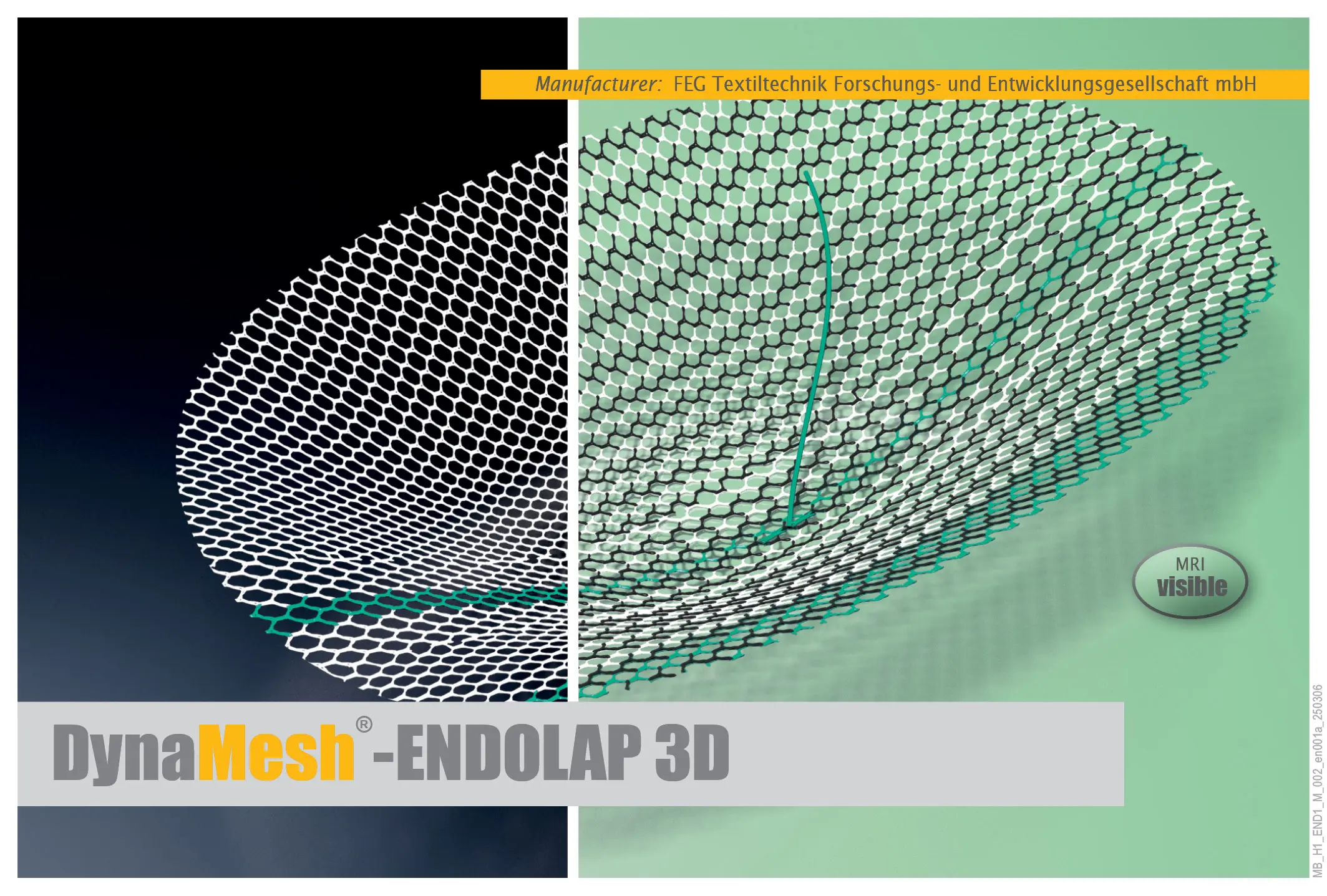 DynaMesh ENDOLAP 3D visible