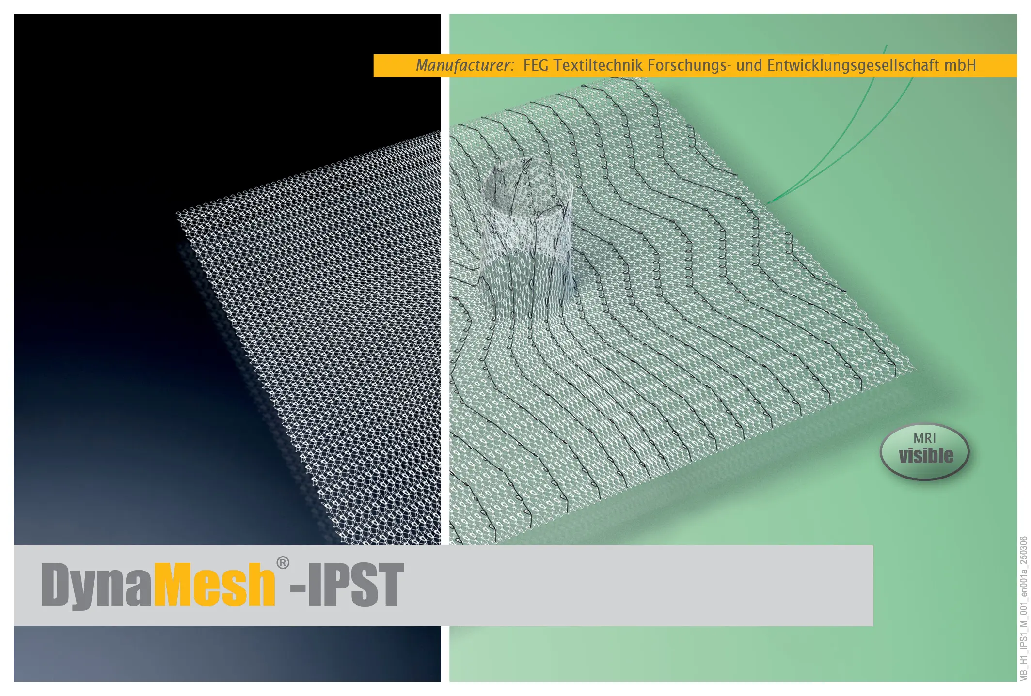 DynaMesh IPST-R visible